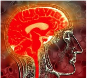 Mary Ackerley The Brain On Fire Role Of Toxic Mold In Another Term For Neuroinflammation Among Alternative Integrative Doctors Is Leaky Brain It S Similar To Gut In That Membranes Are Supposed